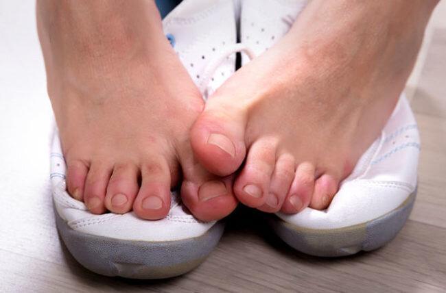 نکته بهداشتی ، جلوگیری از بوی بد پا