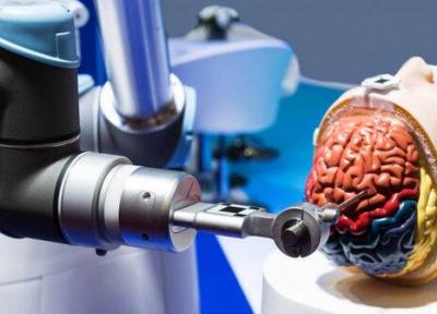 نخستین جراحی آنوریسم مغزی توسط ربات انجام شد